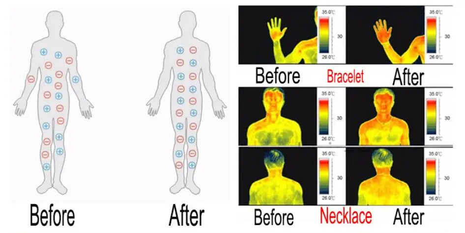 Comparison showing the effect of magnetic copper bracelets and necklaces on skin temperature.