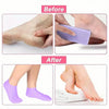 Before and after comparison showing silicone moisturizing socks used to treat cracked feet.