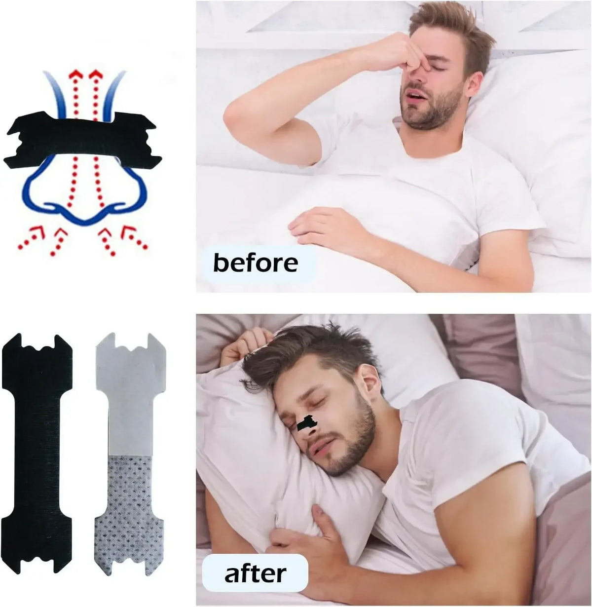 Before and after comparison showing invisible nasal strips for snoring relief used to reduce snoring.