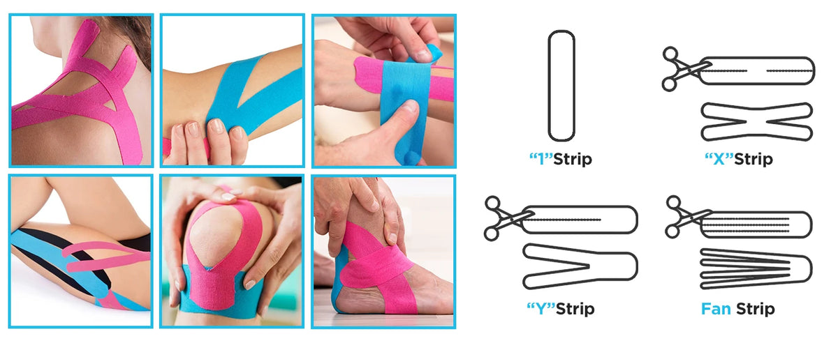 Various types of kinesiology tape including I Strip, X Strip, Y Strip, and Fan Strip shown on skin.