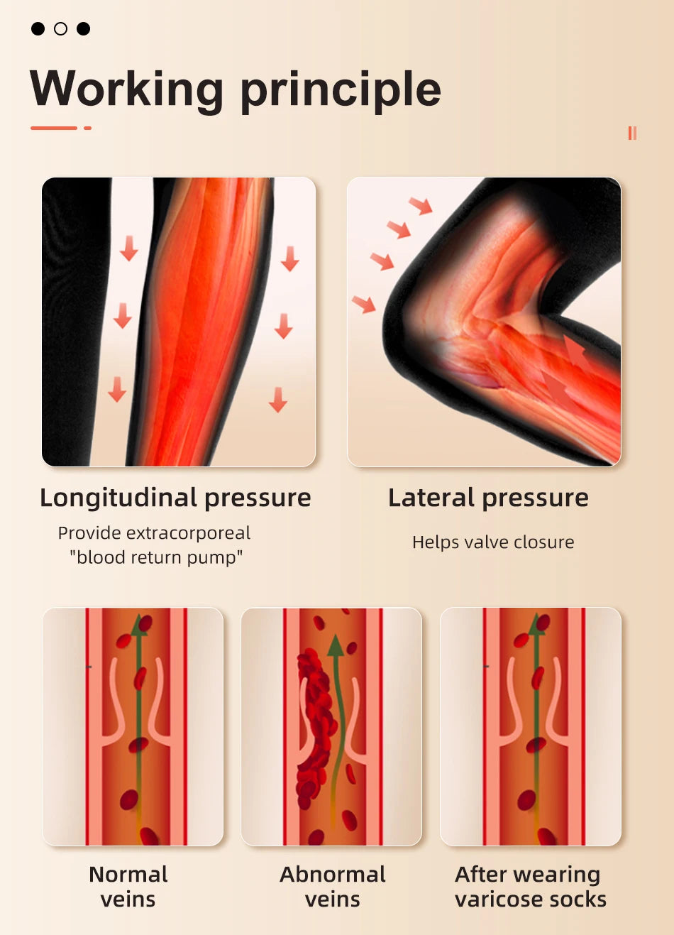 Diagram illustrating working principles of compression stockings, showing longitudinal and lateral pressure effects on veins.