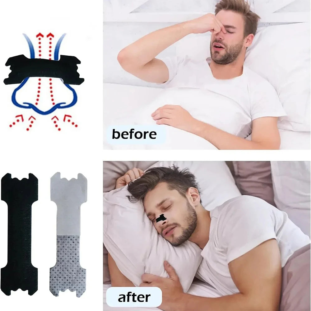 Before and after comparison showing anti-snoring nasal strips for sleep aid device application.