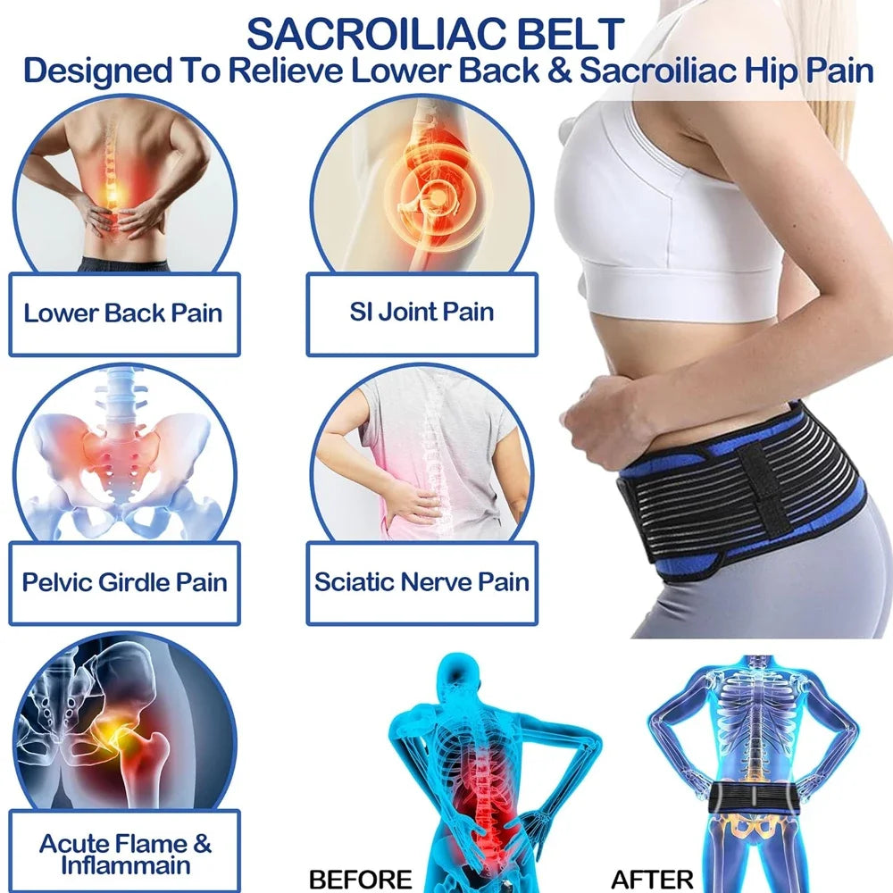 A diagram showing before and after results of a sacroiliac belt for lower back and hip pain relief.