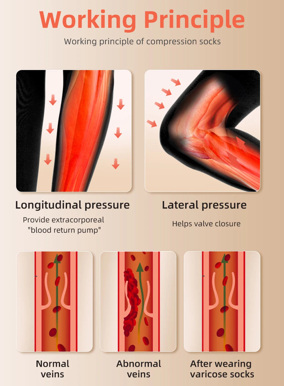 Diagram illustrating the working principle of compression socks showing longitudinal and lateral pressure on veins.