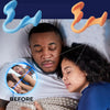 Nasal Dilators for Snoring Relief & Better Sleep