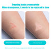 Image showing a hydrocolloid dressing on skin, illustrating how it changes from transparent to saturated liquid over time.