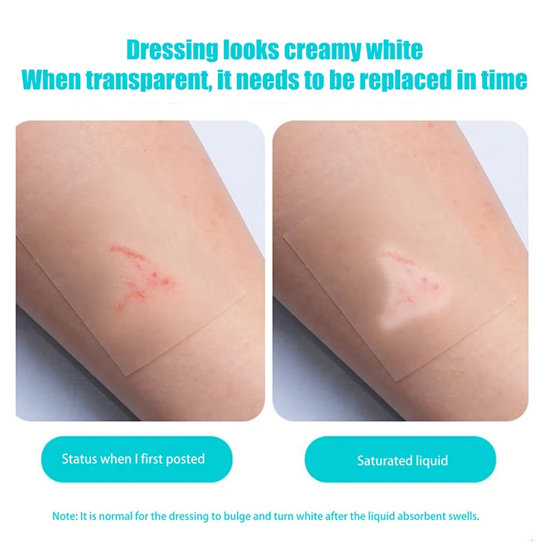 Image showing a hydrocolloid dressing on skin, illustrating how it changes from transparent to saturated liquid over time.
