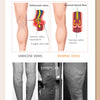 Infographic explaining varicose veins and normal veins, showing symptoms like tissue discoloration and fever.