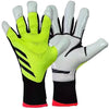 A pair of neon yellow and white latex goalkeeper football gloves shown against a white background.