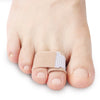 A close-up of a foot showing an orthopedic toe wrap applied to the big toe.
