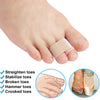 A close-up of a foot showing orthopedic toe wraps used to straighten, stabilize, and treat broken or crooked toes.