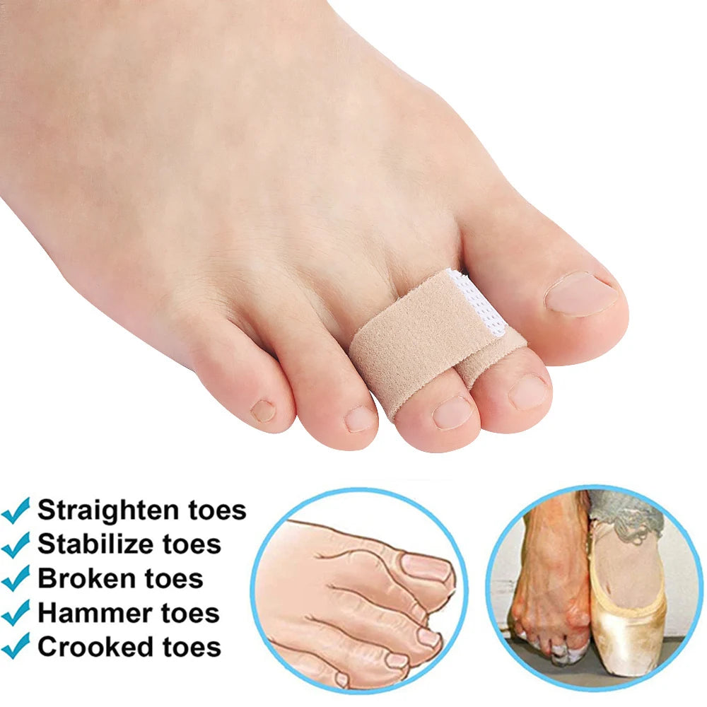 A close-up of a foot showing orthopedic toe wraps used to straighten, stabilize, and treat broken or crooked toes.