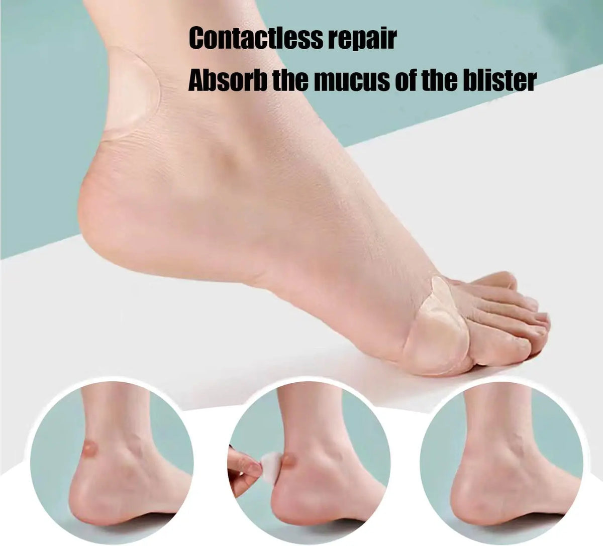 Close-up of a foot showing a contactless repair with hydrocolloid blister gel pads for pain relief