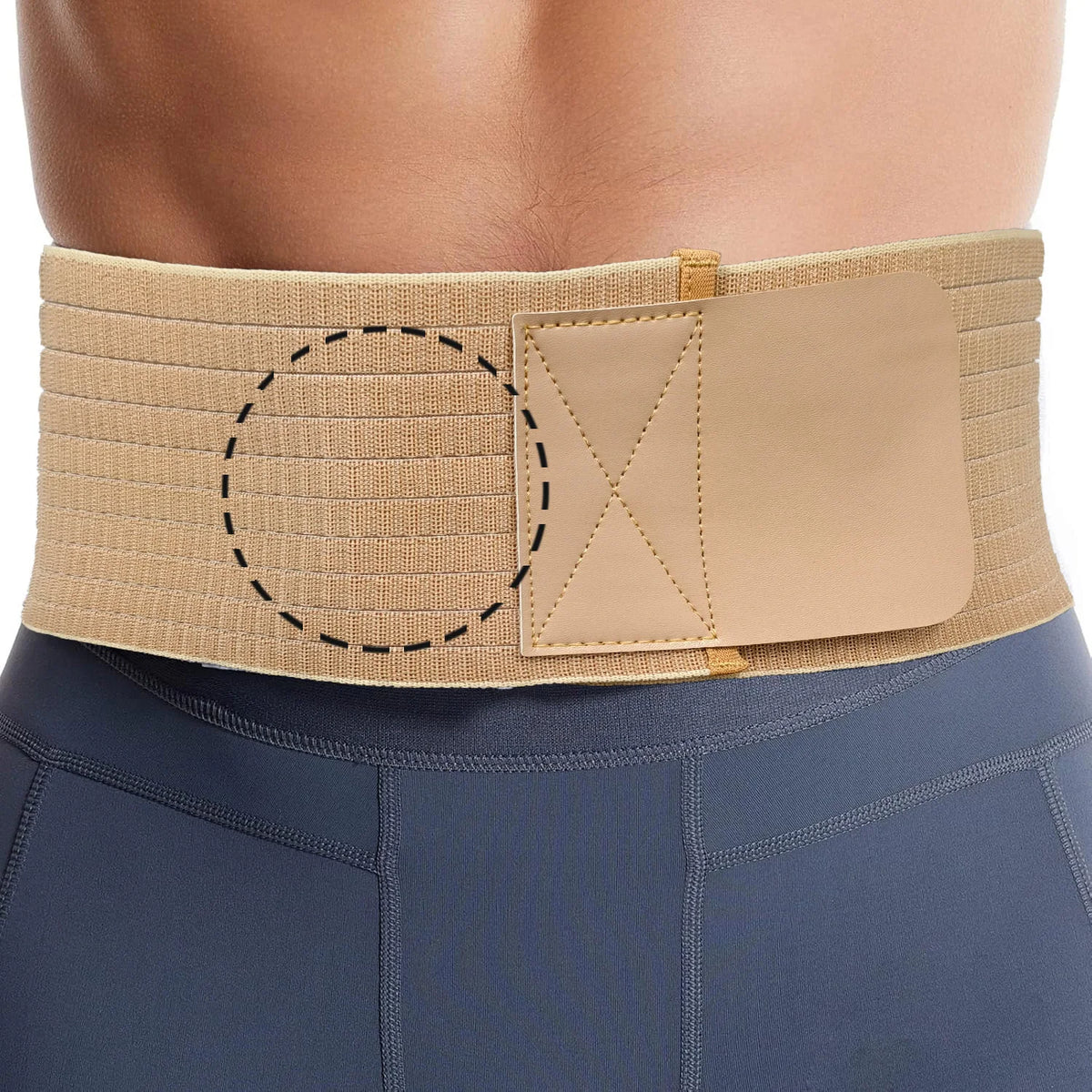 Beige unterstützender Bauchherniengürtel, getragen um die Taille einer Person.