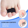 A hand shows an orthopedic toe wrap designed to align, stabilize, and separate toes.