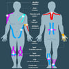 Diagram showing muscle groups and points of application for various sports injuries using kinesiology tape.