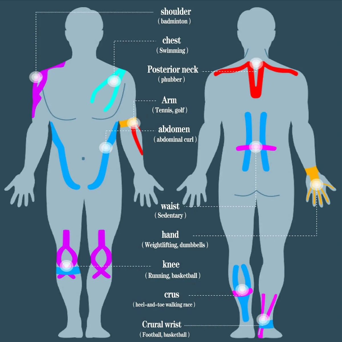 Diagram showing muscle groups and points of application for various sports injuries using kinesiology tape.